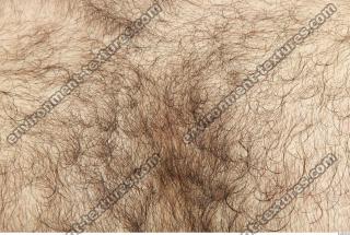 human skin hairy 0004